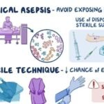 what is aseptic technique
